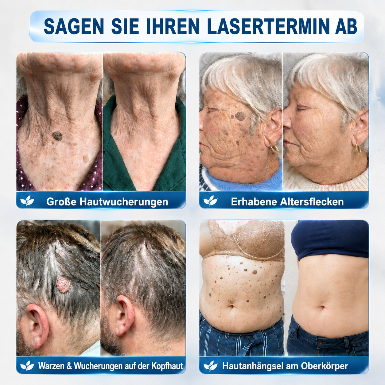 HISKIN®🇩🇪50%