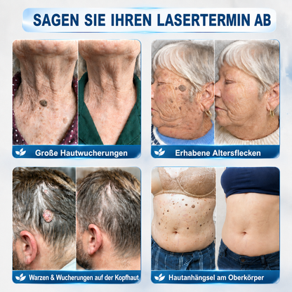 HISKIN®🇩🇪50%